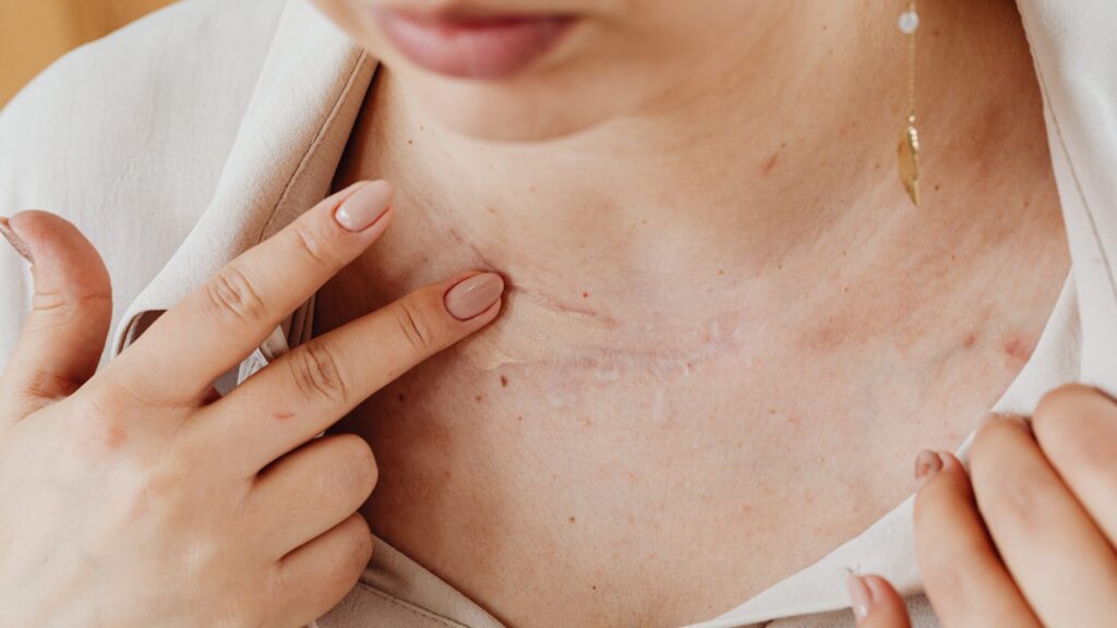 woman showing her scars to the camera.