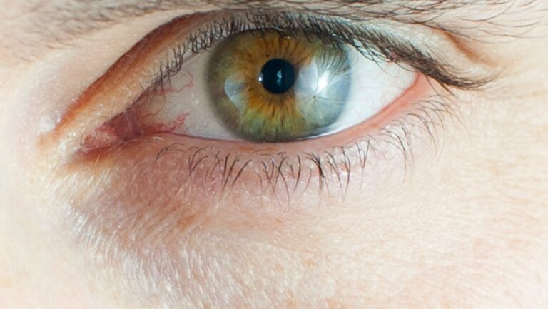 close up of a woman's eye with open pores