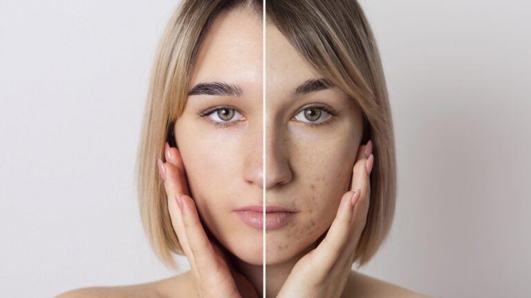 a woman showing a photo of before and after of minimizing pores