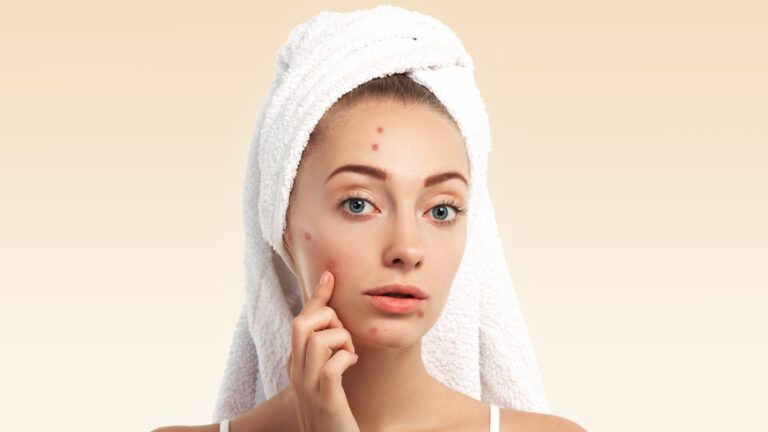 woman with towel on her head touching her face to look at her pores and acne