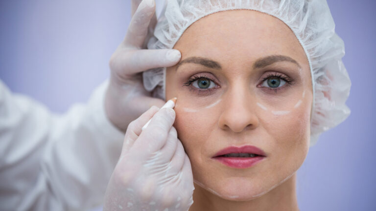 woman getting markings around her eyes for an under-eye filler