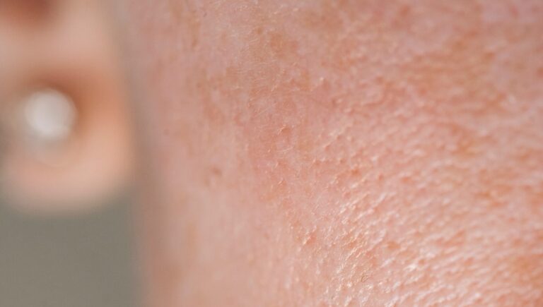 photo of a woman's face before minimizing pores