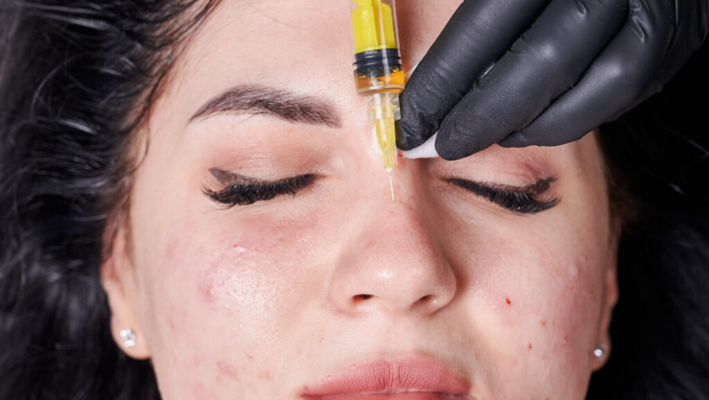 Close up of female patient with problematic acne skin receiving injections at wellness center. Doctor cosmetologist injecting patient nose.